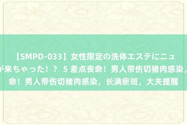 【SMPD-033】女性限定の洗体エステにニューハーフのお客さんが来ちゃった！？ 5 差点丧命！男人带伤切猪肉感染，长满瘀斑，大夫提醒